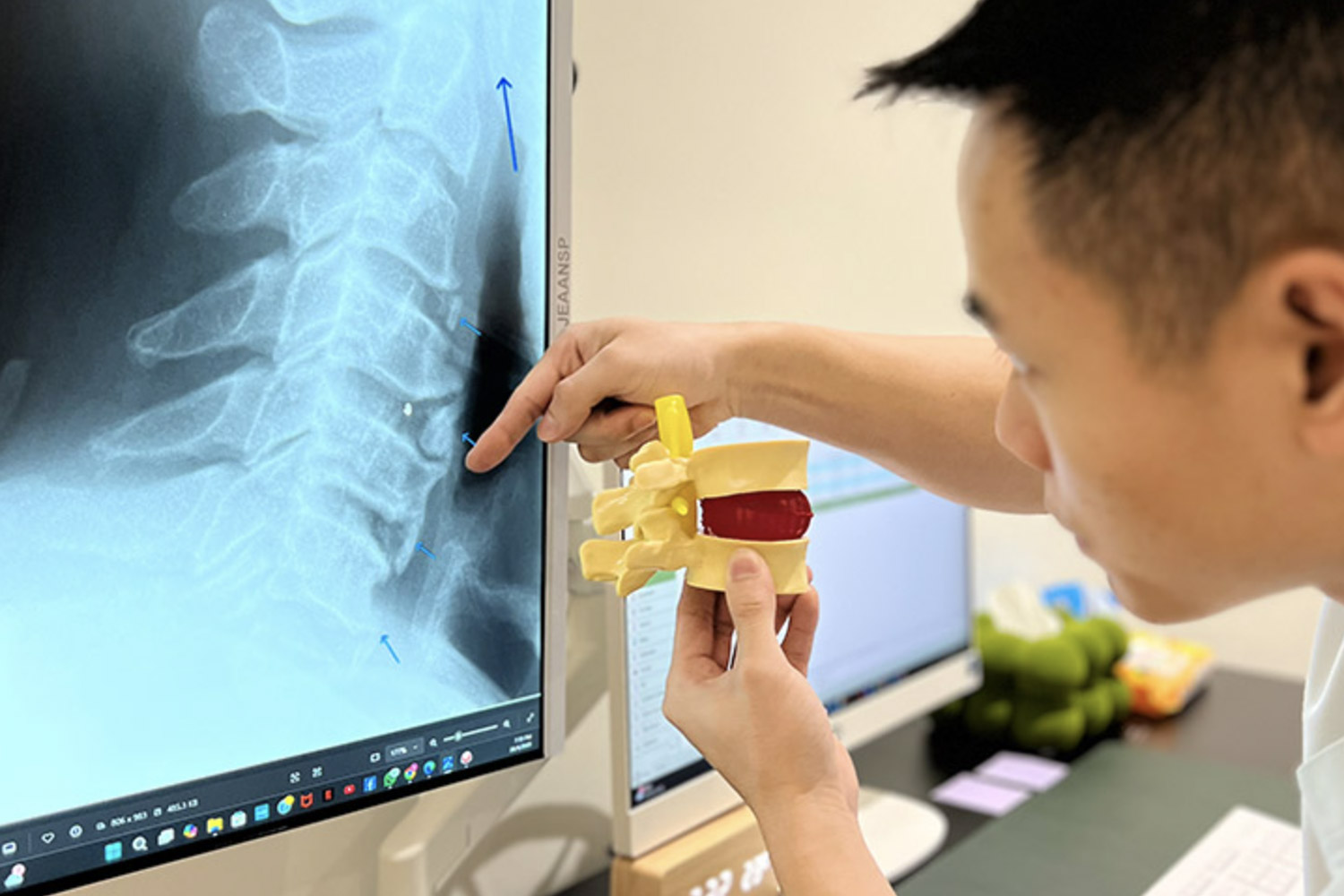 Just Chiro - X-Ray Analysis to diagnose and development tailored treatment plan